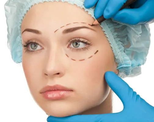 Blefaroplastia: Redefiniendo la Belleza a través de la Precisión Quirúrgica